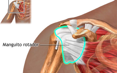 Rehabilitación efectiva: Tratamiento recomendado para lesiones en el hombro